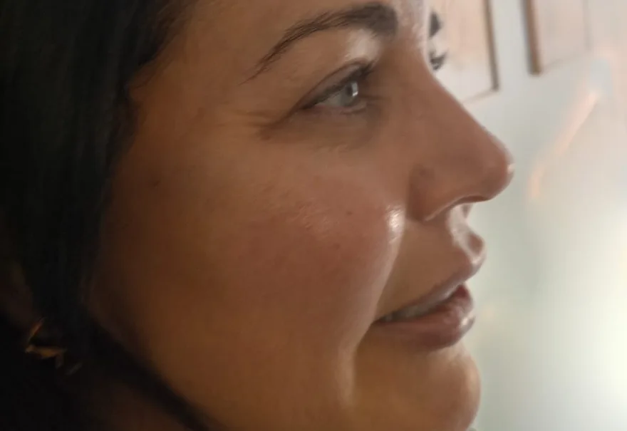 Perfil de paciente mostrando o contorno do rosto